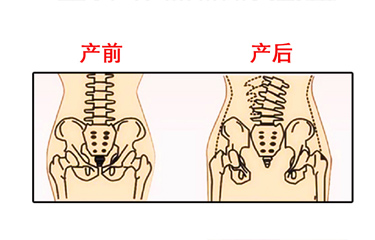 月子期間盆骨儀器修復(fù)時(shí)間有限制嗎？與手法修復(fù)相比哪個(gè)效果好？